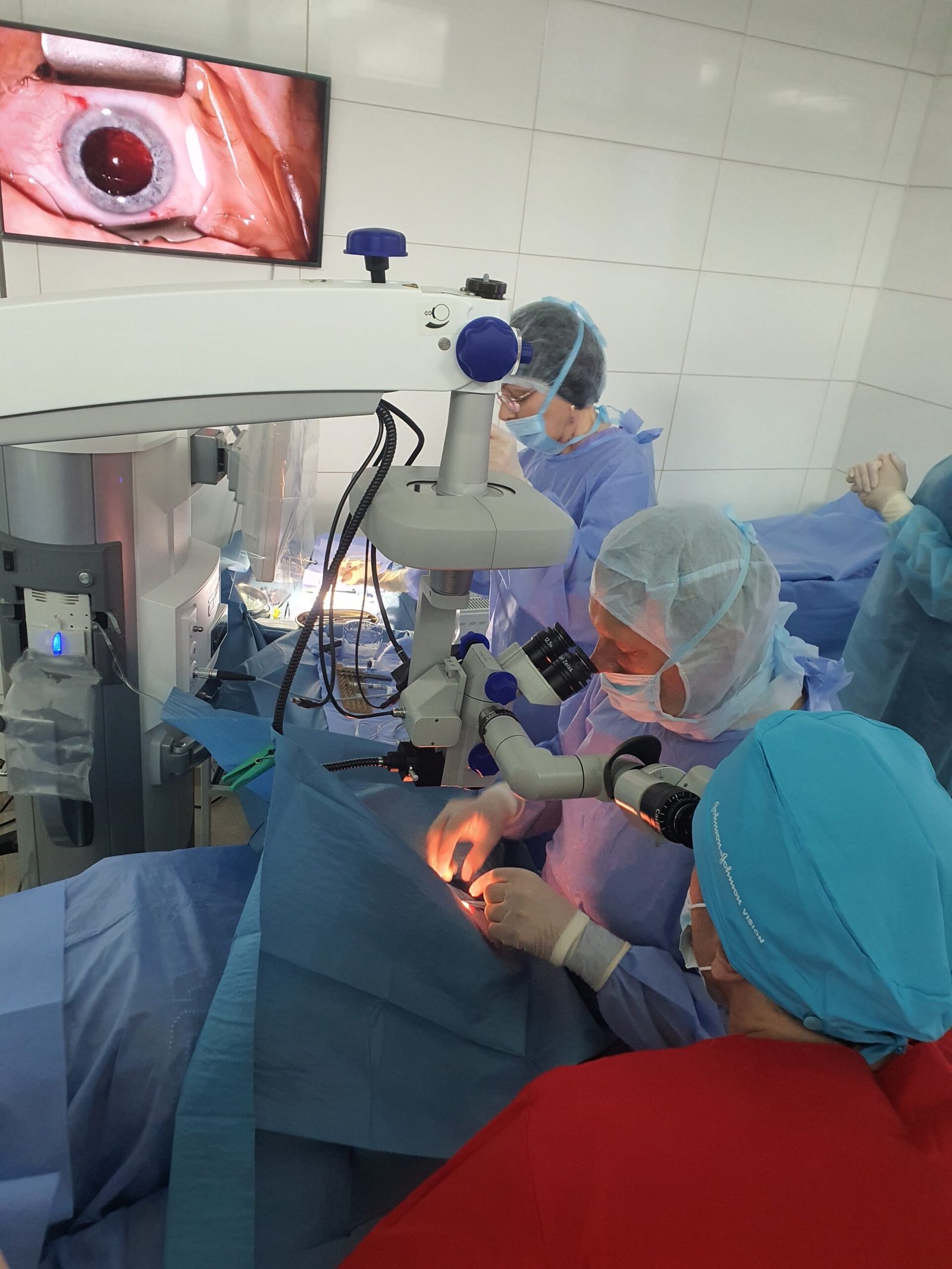 імплантація Pure See 11