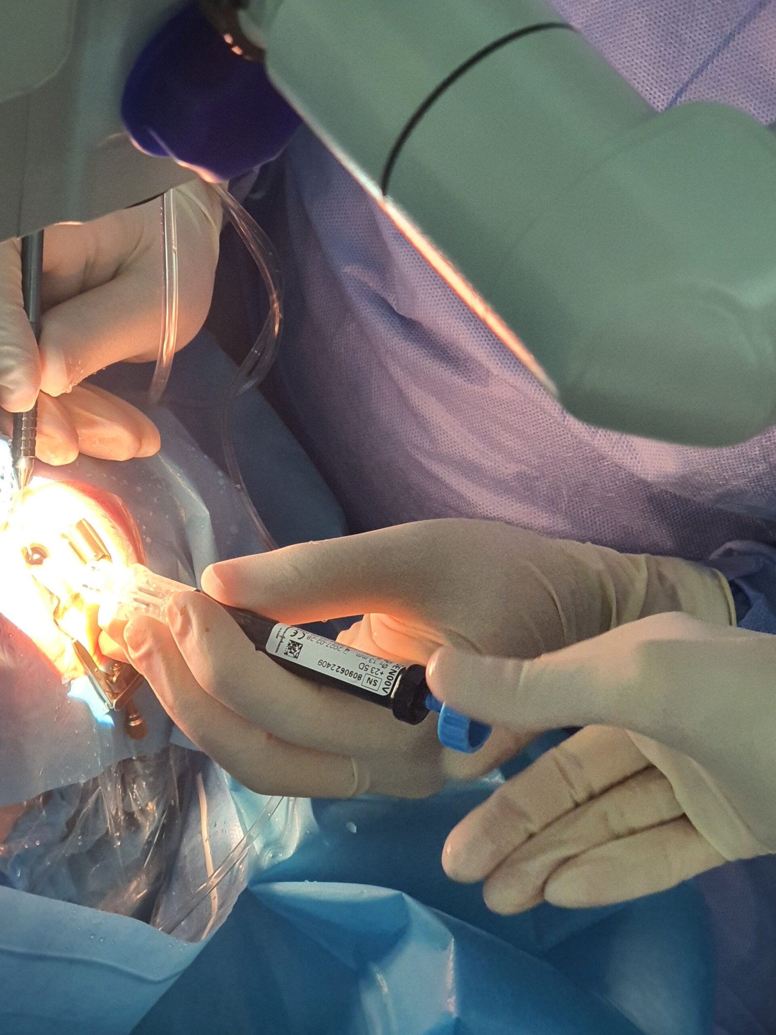 імплантація Pure See 2